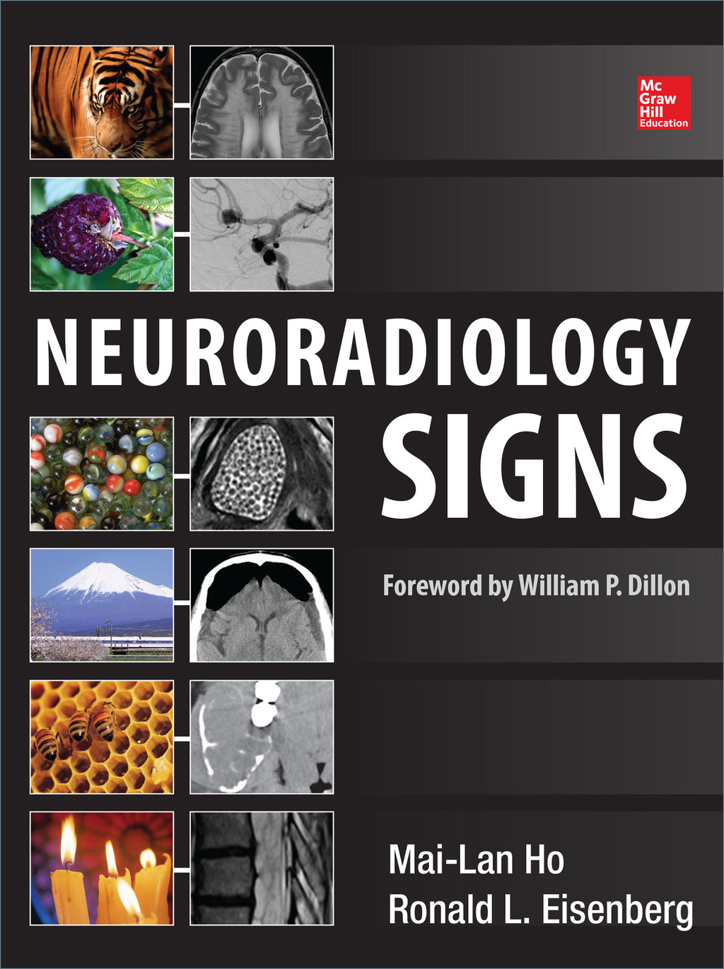 Neuroradiology Signs 1st Edition â€“ PDF/EPUB Version Downloadable