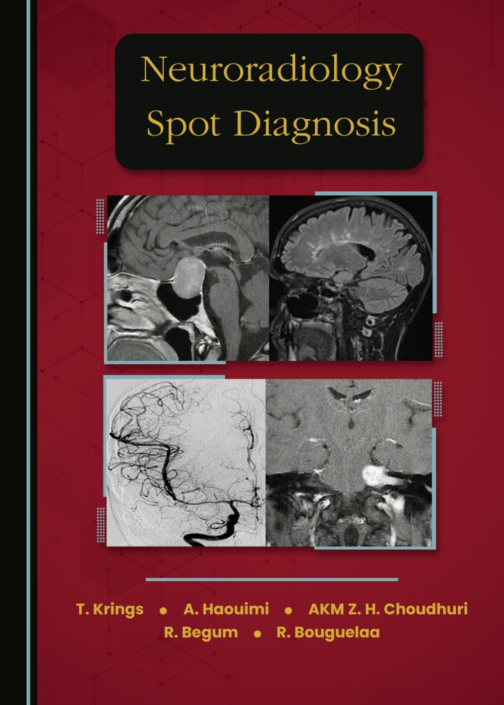 Neuroradiology Spot Diagnosis 1st Edition â€“ PDF/EPUB Version Downloadable
