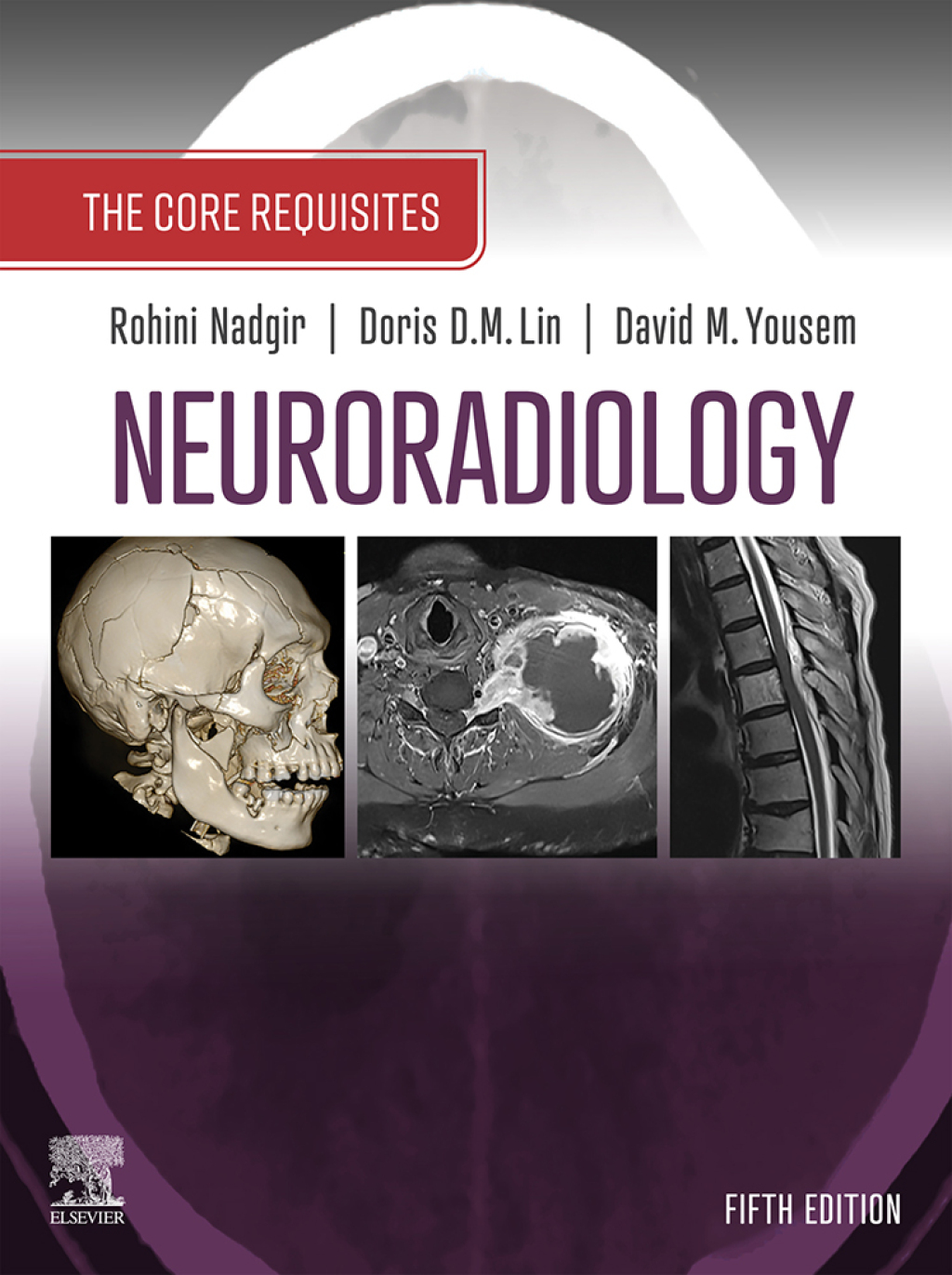 Neuroradiology: The Core Requisites 5th Edition â€“ PDF/EPUB Version Downloadable