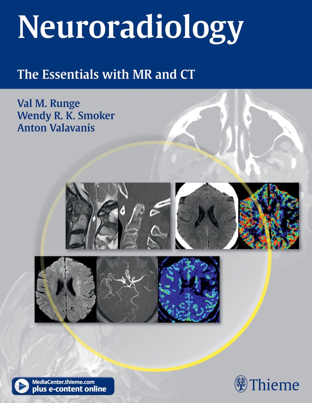 Neuroradiology The Essentials with MR and CT 1st Edition â€“ PDF/EPUB Version Downloadable