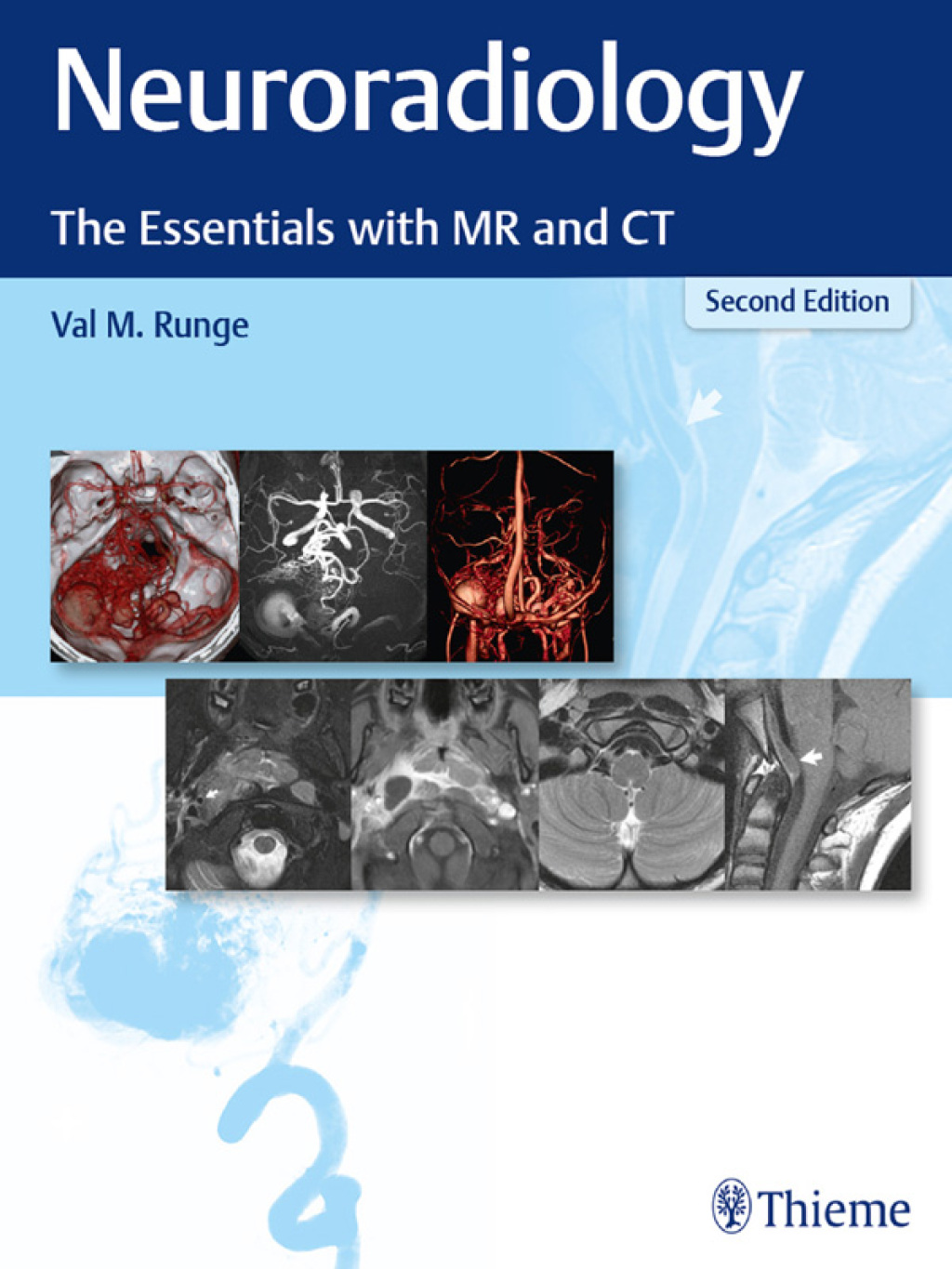 Neuroradiology The Essentials with MR and CT 2nd Edition â€“ PDF/EPUB Version Downloadable