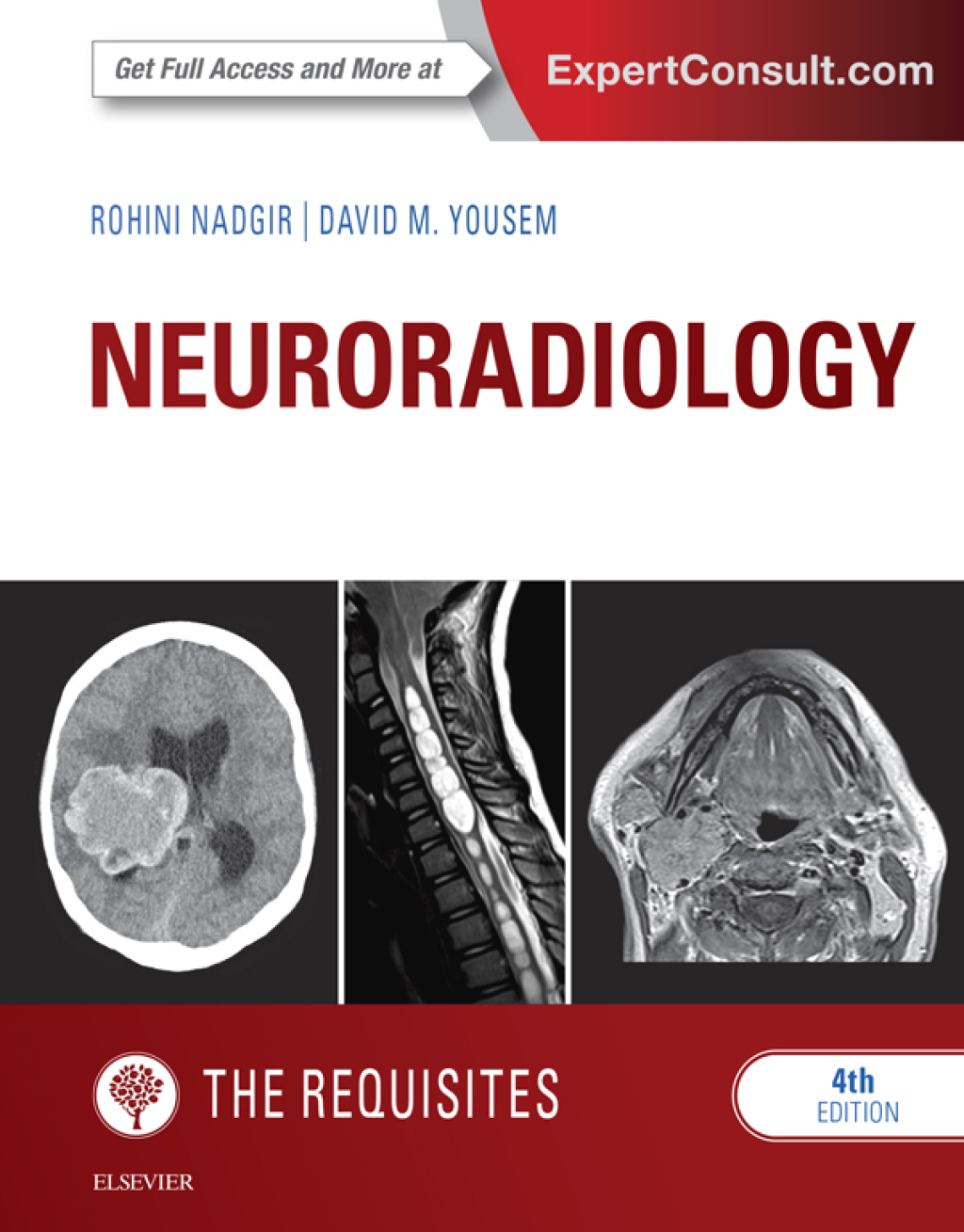 Neuroradiology: The Requisites 4th Edition â€“ PDF/EPUB Version Downloadable