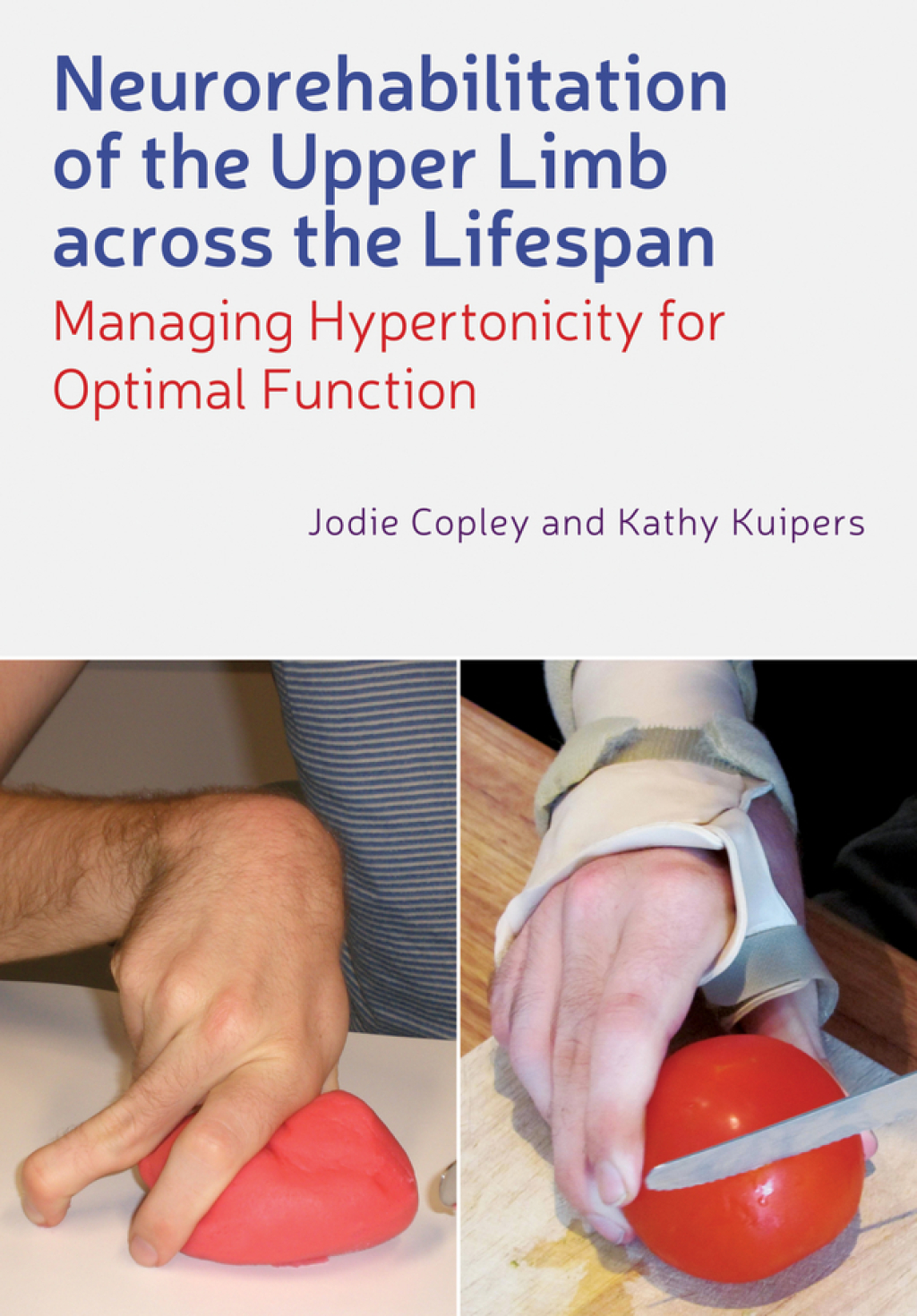 Neurorehabilitation of the Upper Limb Across the Lifespan Managing Hypertonicity for Optimal Function 1st Edition â€“ PDF/EPUB Version Downloadable