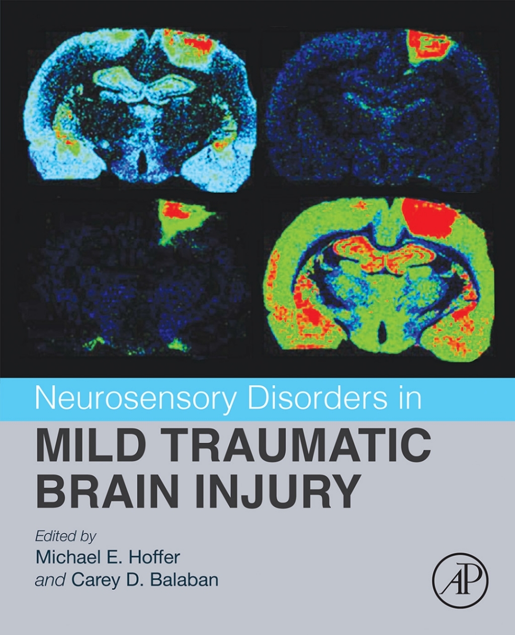 Neurosensory Disorders in Mild Traumatic Brain Injury  â€“ PDF/EPUB Version Downloadable