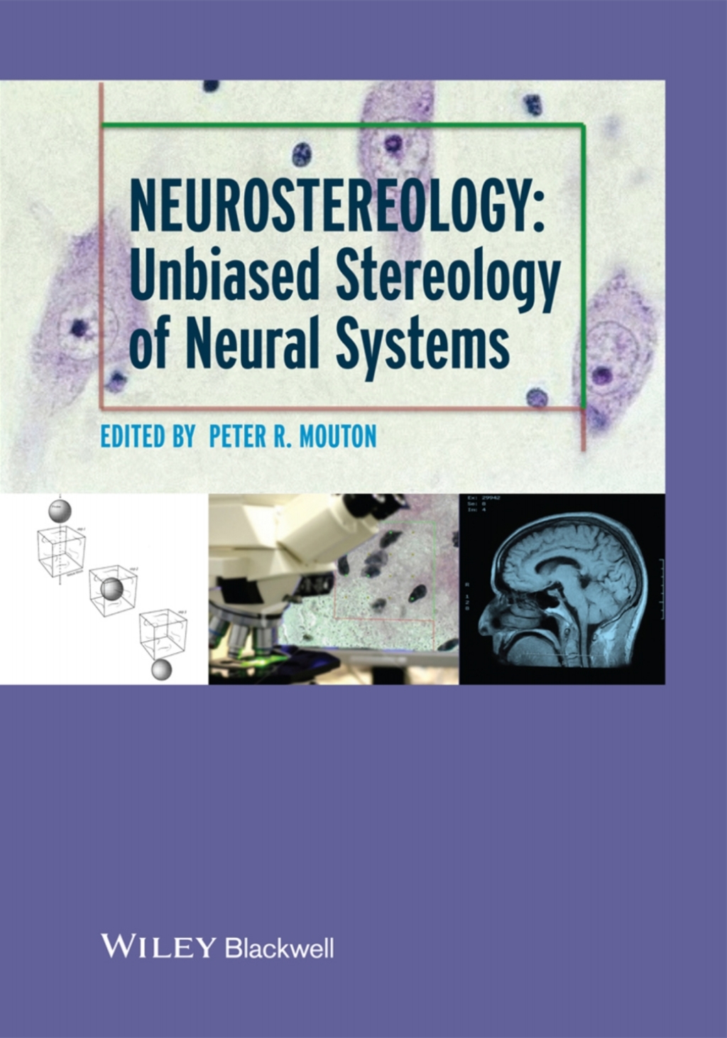 Neurostereology Unbiased Stereology of Neural Systems 1st Edition â€“ PDF/EPUB Version Downloadable