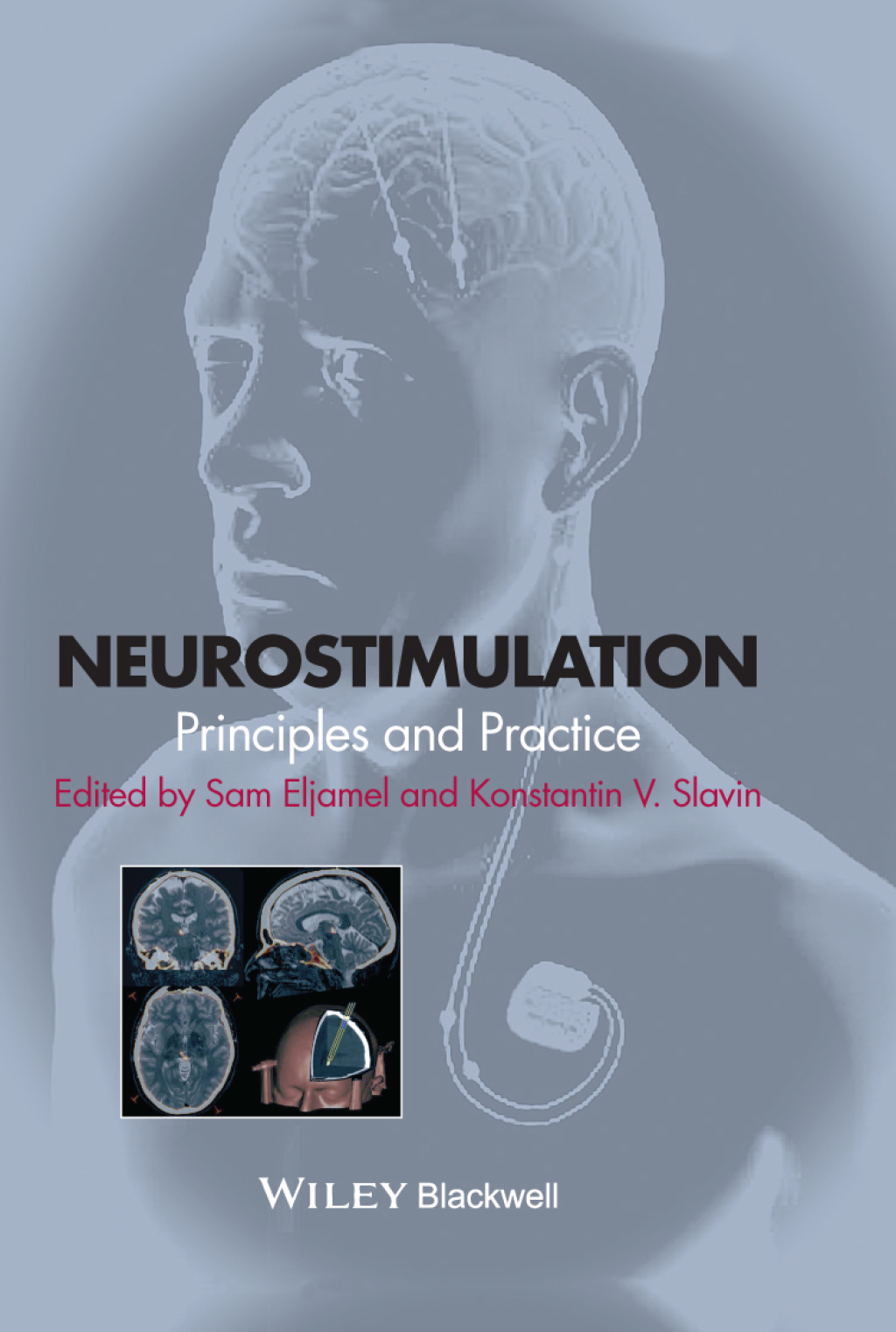 Neurostimulation: Principles and Practice Principles and Practice 1st Edition â€“ PDF/EPUB Version Downloadable