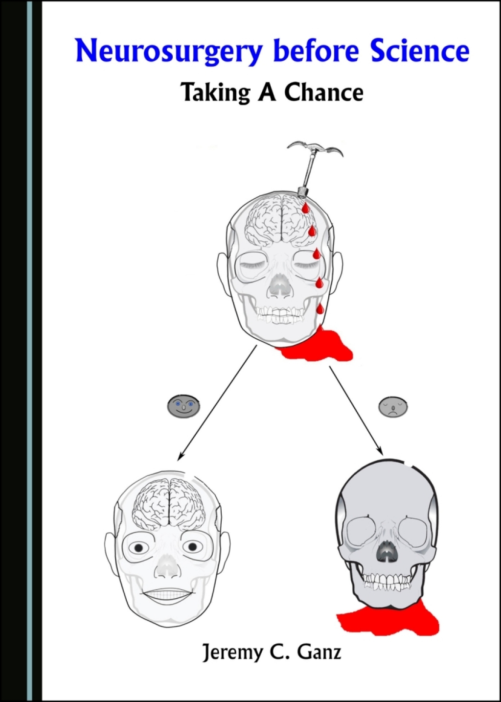 Neurosurgery before Science Taking a Chance 1st Edition â€“ PDF/EPUB Version Downloadable