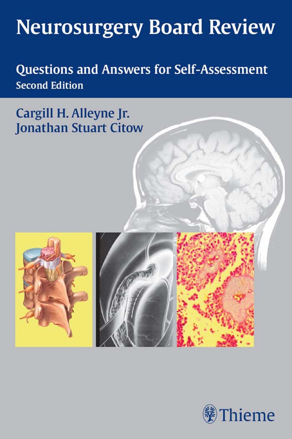 Neurosurgery Board Review Questions and Answers for Self-Assessment 2nd Edition â€“ PDF/EPUB Version Downloadable