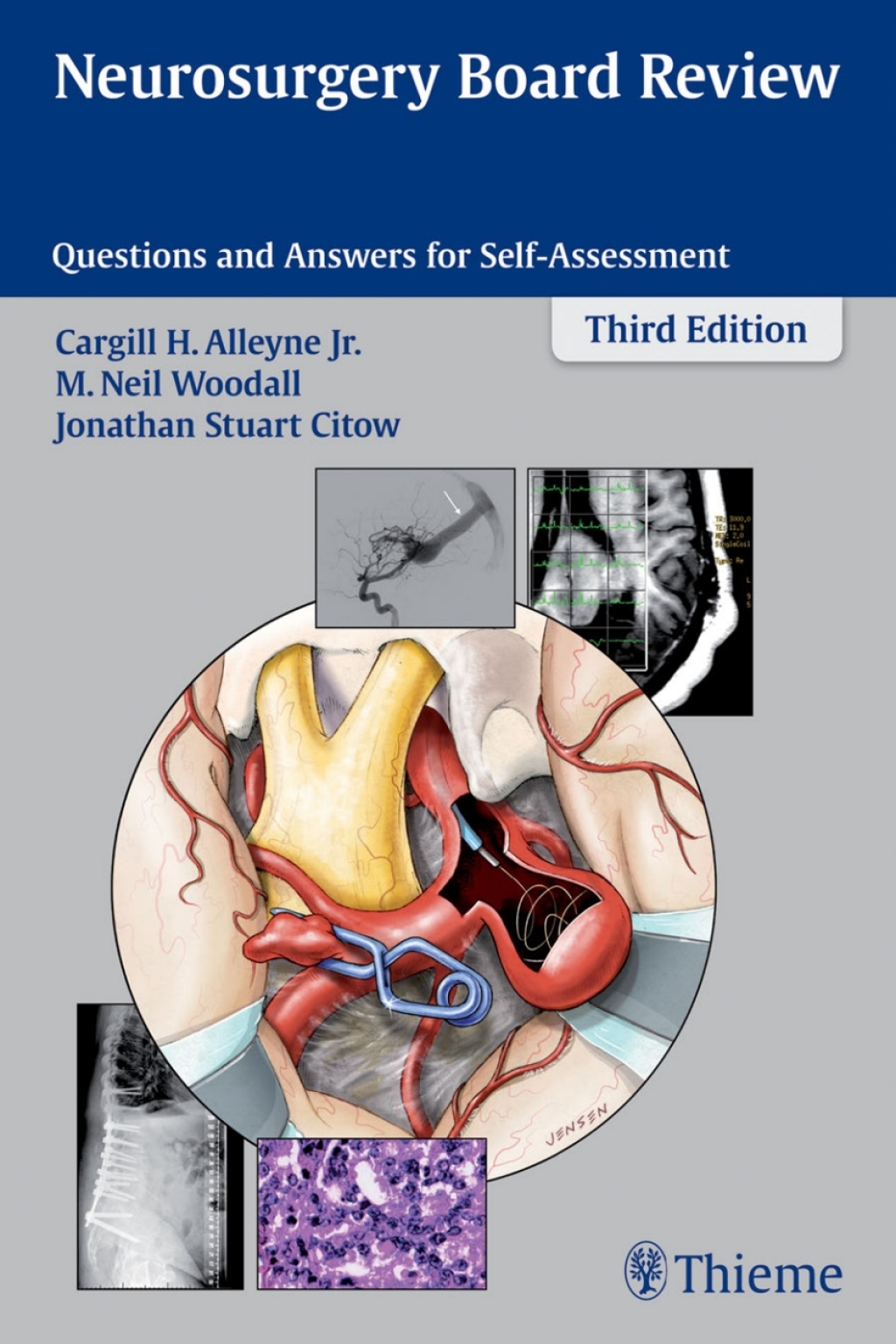 Neurosurgery Board Review Questions and Answers for Self-Assessment 3rd Edition â€“ PDF/EPUB Version Downloadable
