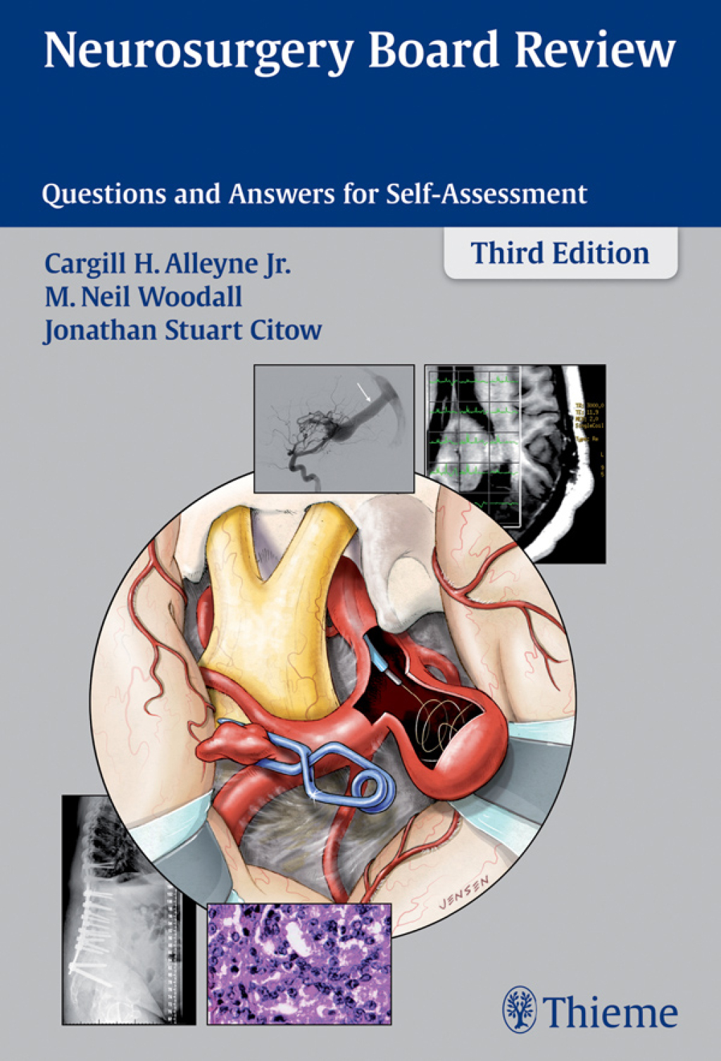 Neurosurgery Board Review Questions and Answers for Self-Assessment 3rd Edition â€“ PDF/EPUB Version Downloadable