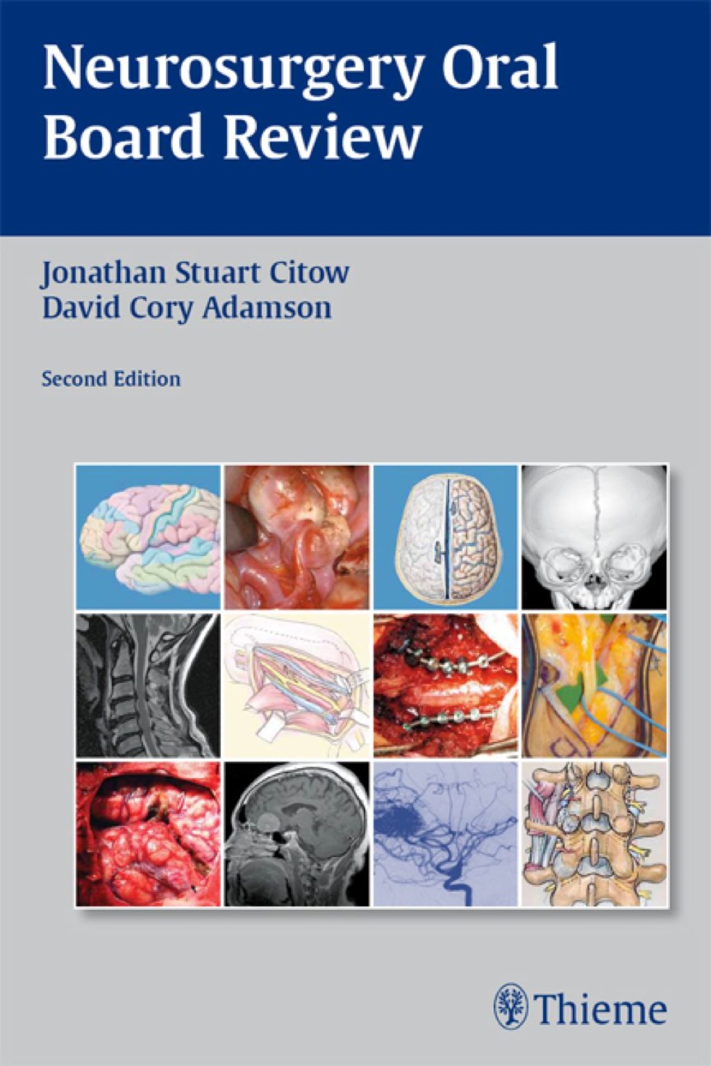 Neurosurgery Oral Board Review 2nd Edition â€“ PDF/EPUB Version Downloadable
