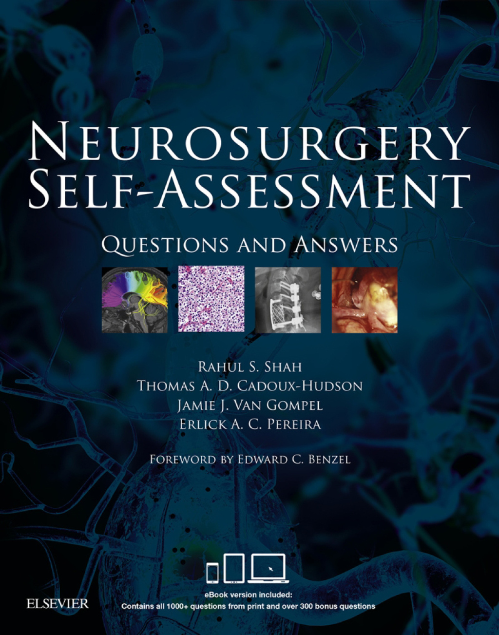 Neurosurgery Self-Assessment Questions and Answers 1st Edition â€“ PDF/EPUB Version Downloadable