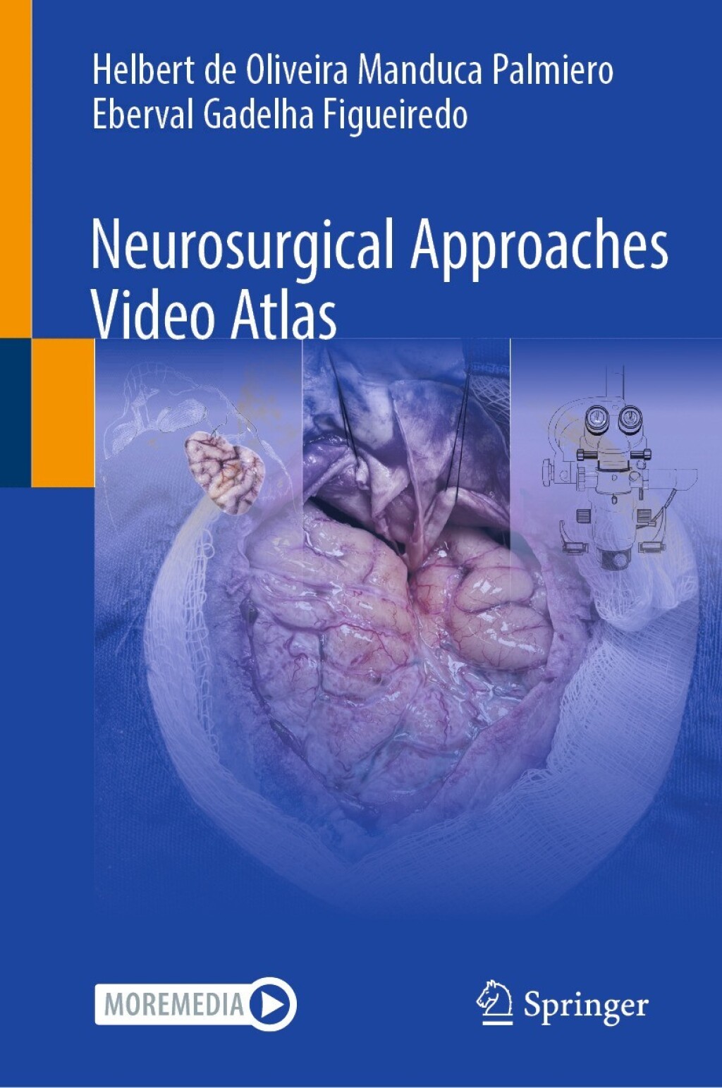 Neurosurgical Approaches Video Atlas  â€“ PDF/EPUB Version Downloadable