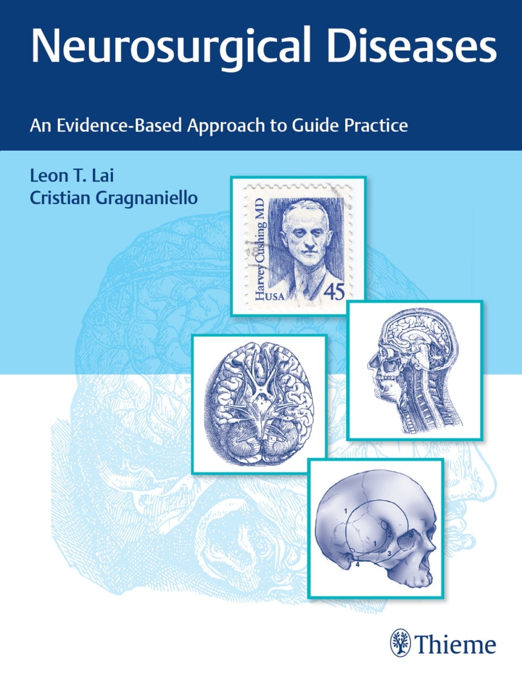 Neurosurgical Diseases An Evidence-Based Approach to Guide Practice 1st Edition â€“ PDF/EPUB Version Downloadable