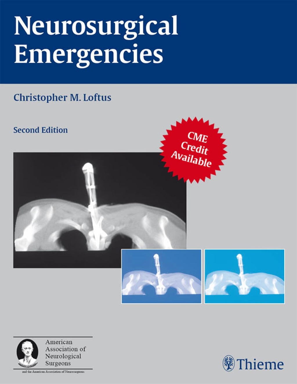 Neurosurgical Emergencies 2nd Edition â€“ PDF/EPUB Version Downloadable