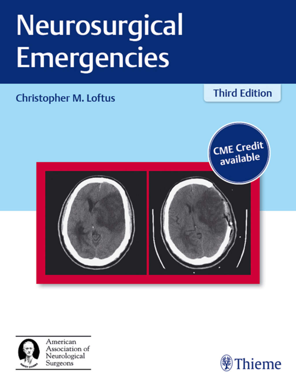 Neurosurgical Emergencies 3rd Edition â€“ PDF/EPUB Version Downloadable