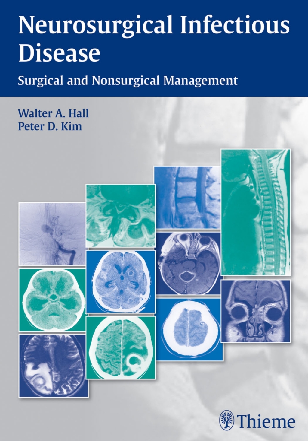 Neurosurgical Infectious Disease Surgical and Nonsurgical Management 1st Edition â€“ PDF/EPUB Version Downloadable