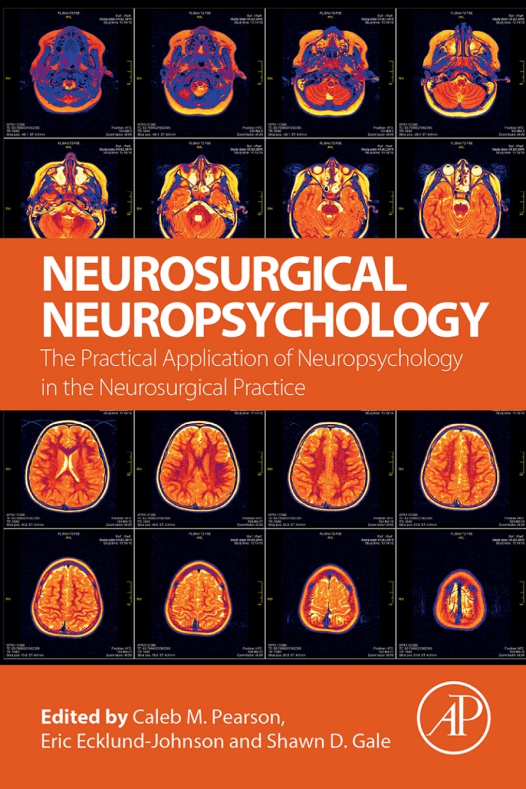 Neurosurgical Neuropsychology The Practical Application of Neuropsychology in the Neurosurgical Practice  â€“ PDF/EPUB Version Downloadable