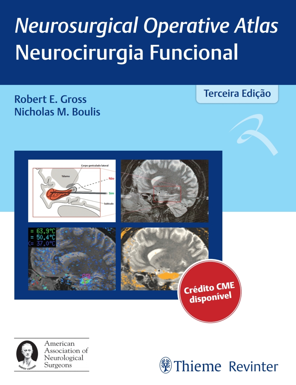 Neurosurgical Operative Atlas - Neurocirurgia Funcional 3rd Edition â€“ PDF/EPUB Version Downloadable