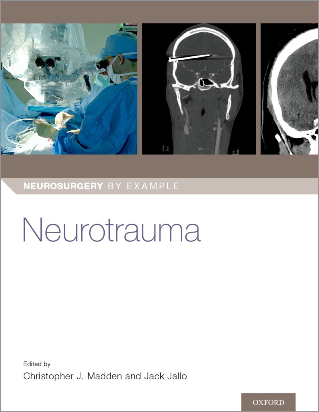 Neurotrauma 1st Edition â€“ PDF/EPUB Version Downloadable