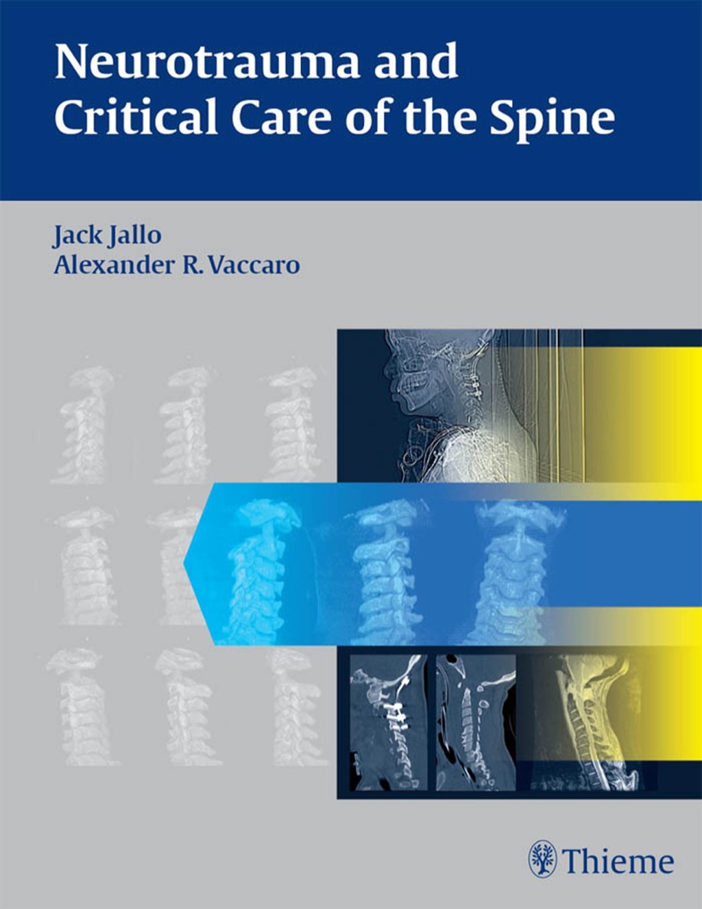Neurotrauma and Critical Care of the Spine 1st Edition â€“ PDF/EPUB Version Downloadable