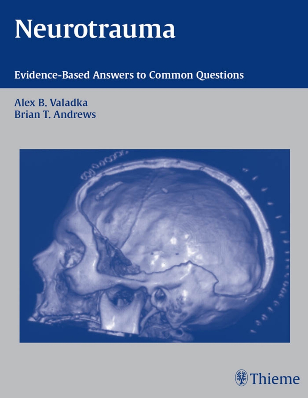 Neurotrauma Evidence-Based Answers to Common Questions 1st Edition â€“ PDF/EPUB Version Downloadable