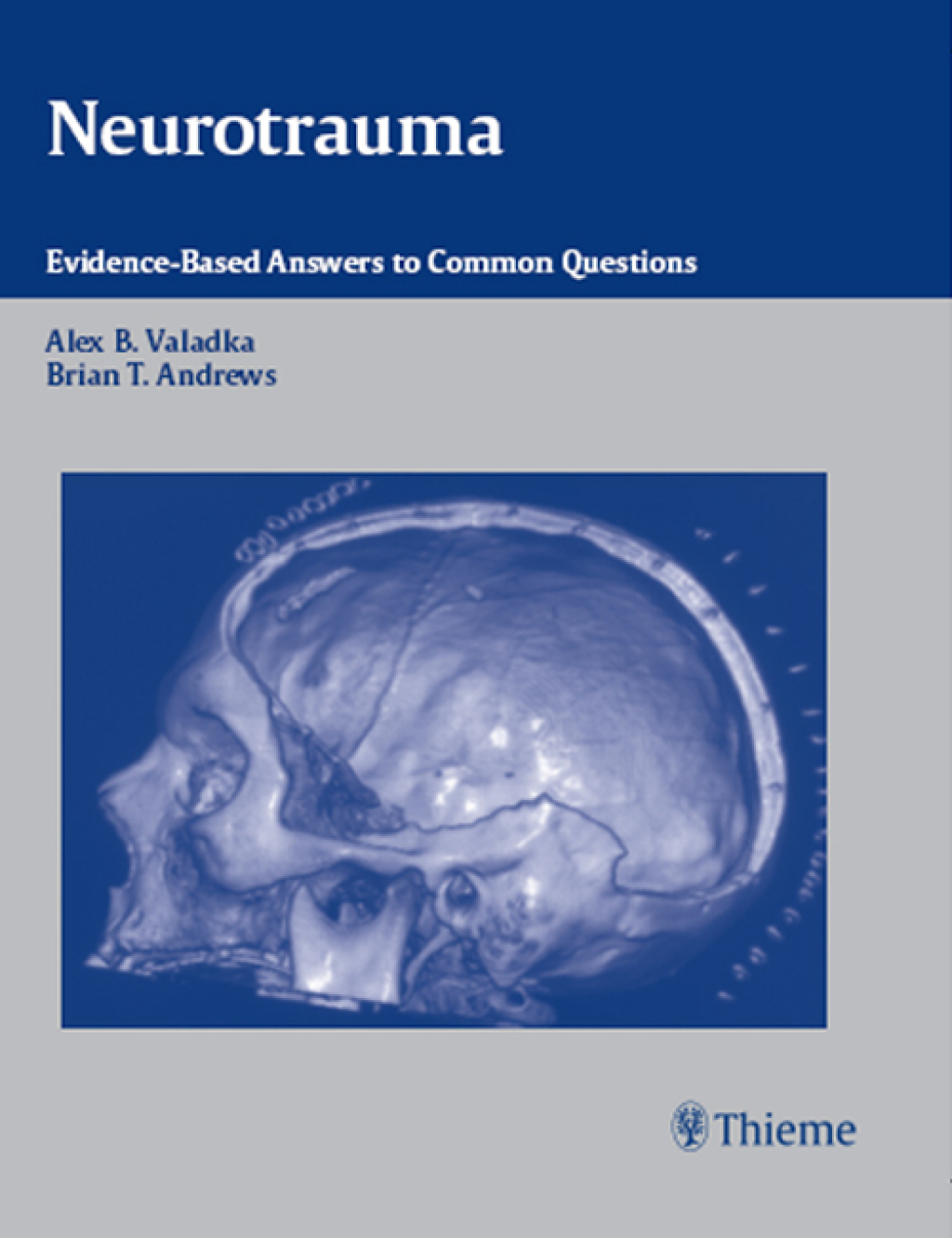 Neurotrauma Evidence-Based Answers to Common Questions 1st Edition â€“ PDF/EPUB Version Downloadable