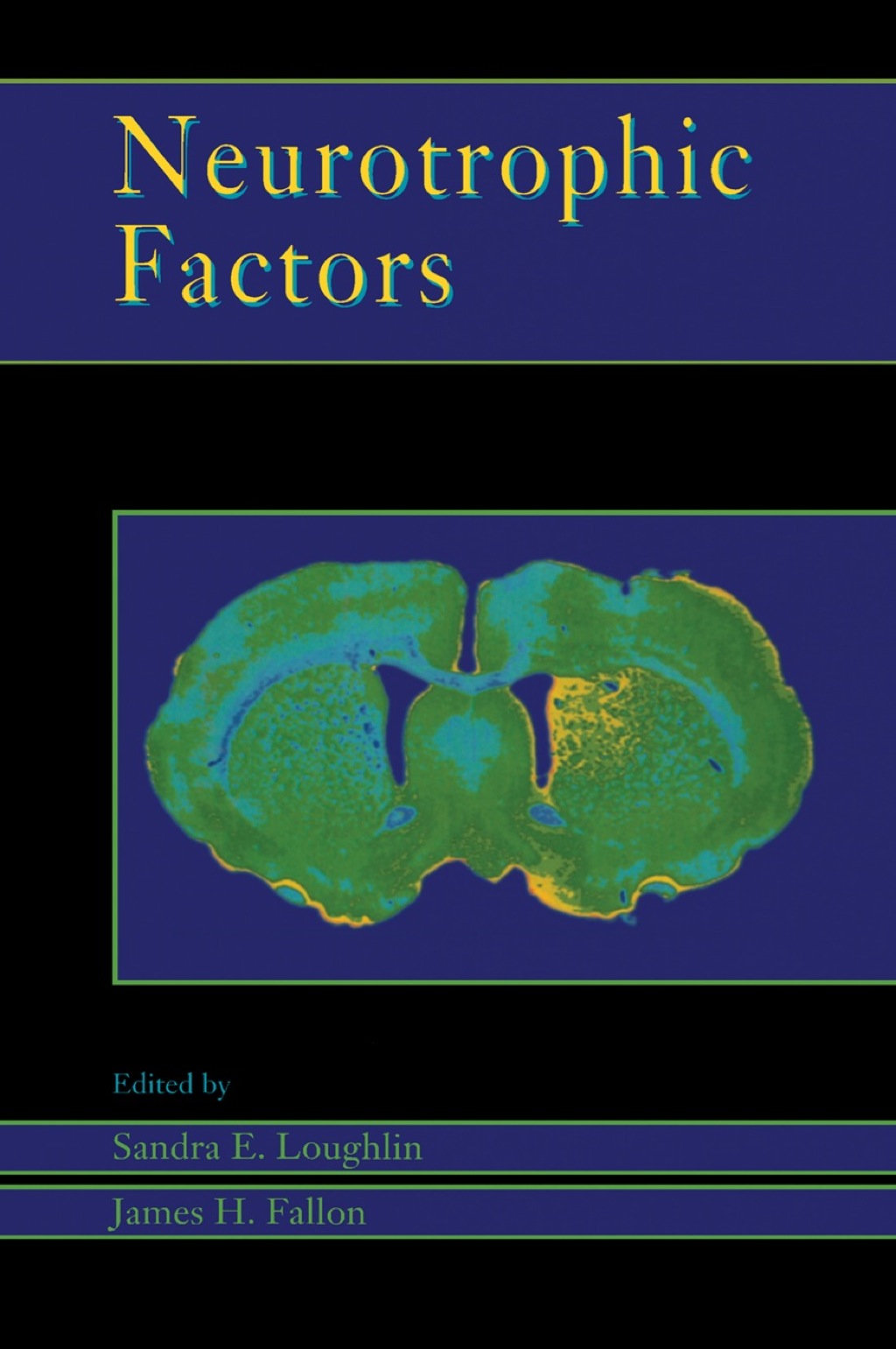 Neurotrophic Factors 1st Edition â€“ PDF/EPUB Version Downloadable