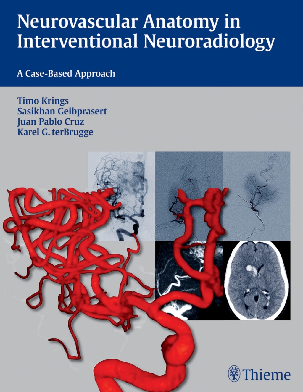 Neurovascular Anatomy in Interventional Neuroradiology A Case-Based Approach 1st Edition â€“ PDF/EPUB Version Downloadable