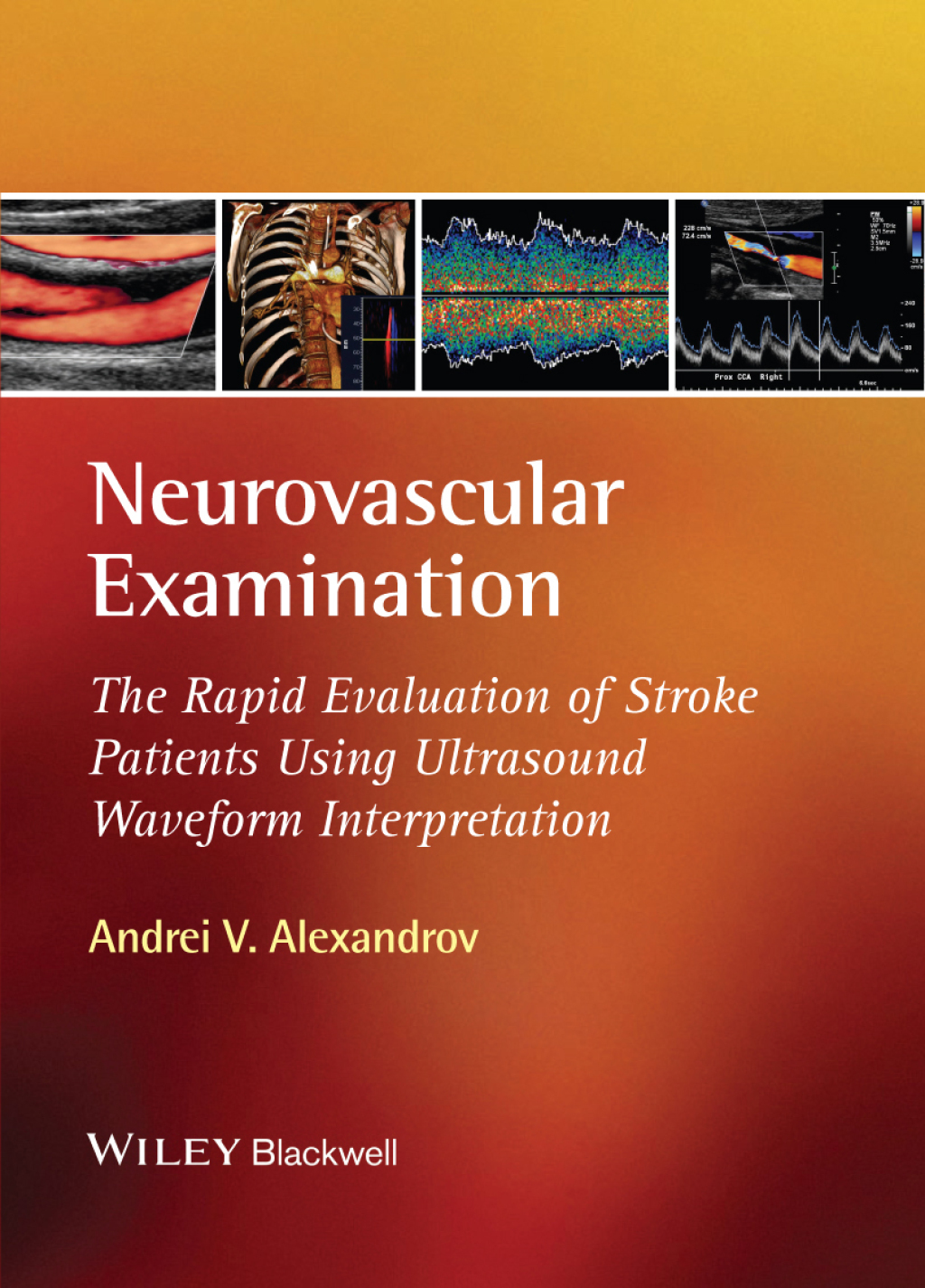 Neurovascular Examination The Rapid Evaluation of Stroke Patients Using Ultrasound Waveform Interpretation 1st Edition â€“ PDF/EPUB Version Downloadable