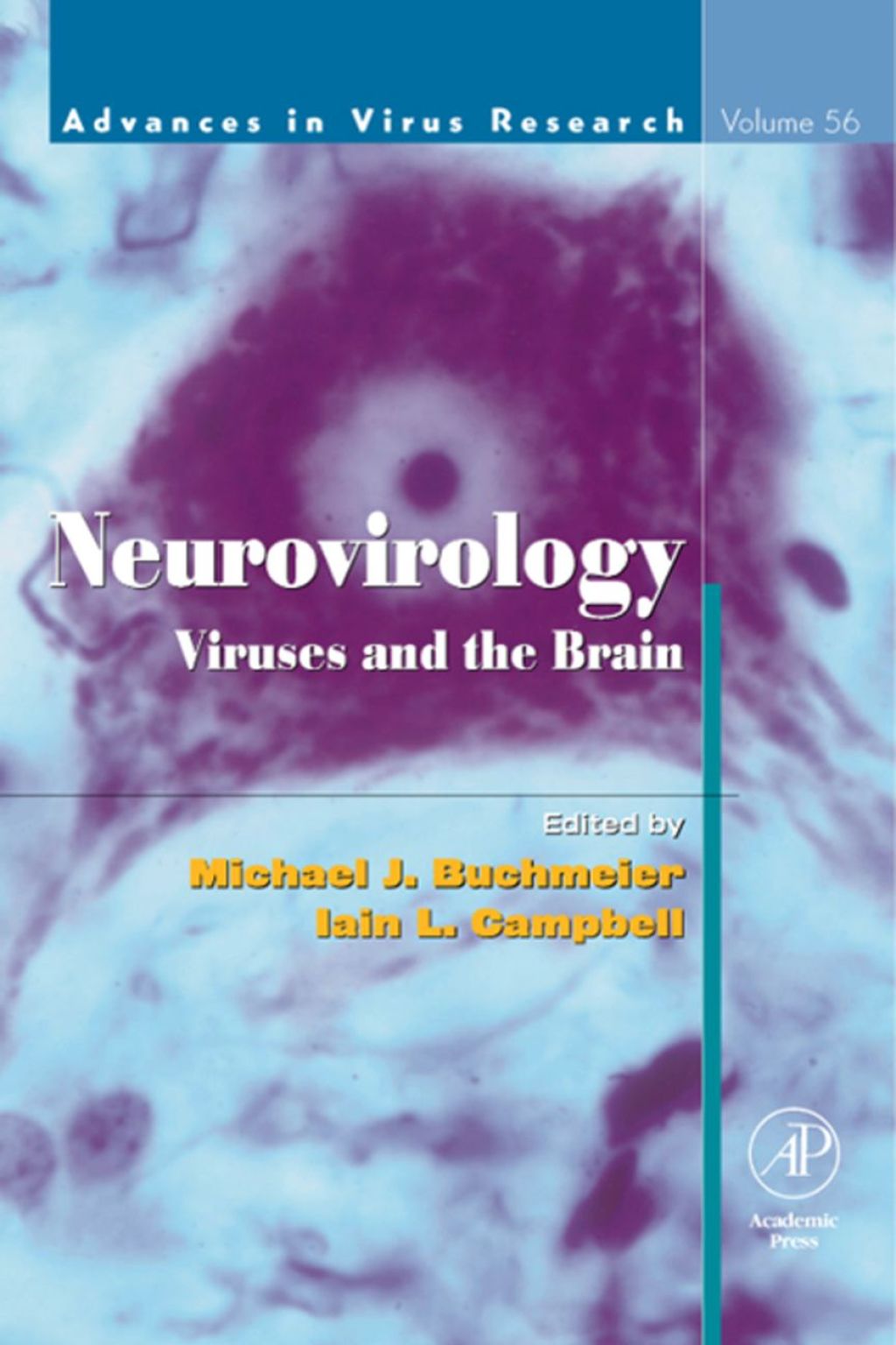 Neurovirology: Viruses and the Brain: Viruses and the Brain  â€“ PDF/EPUB Version Downloadable