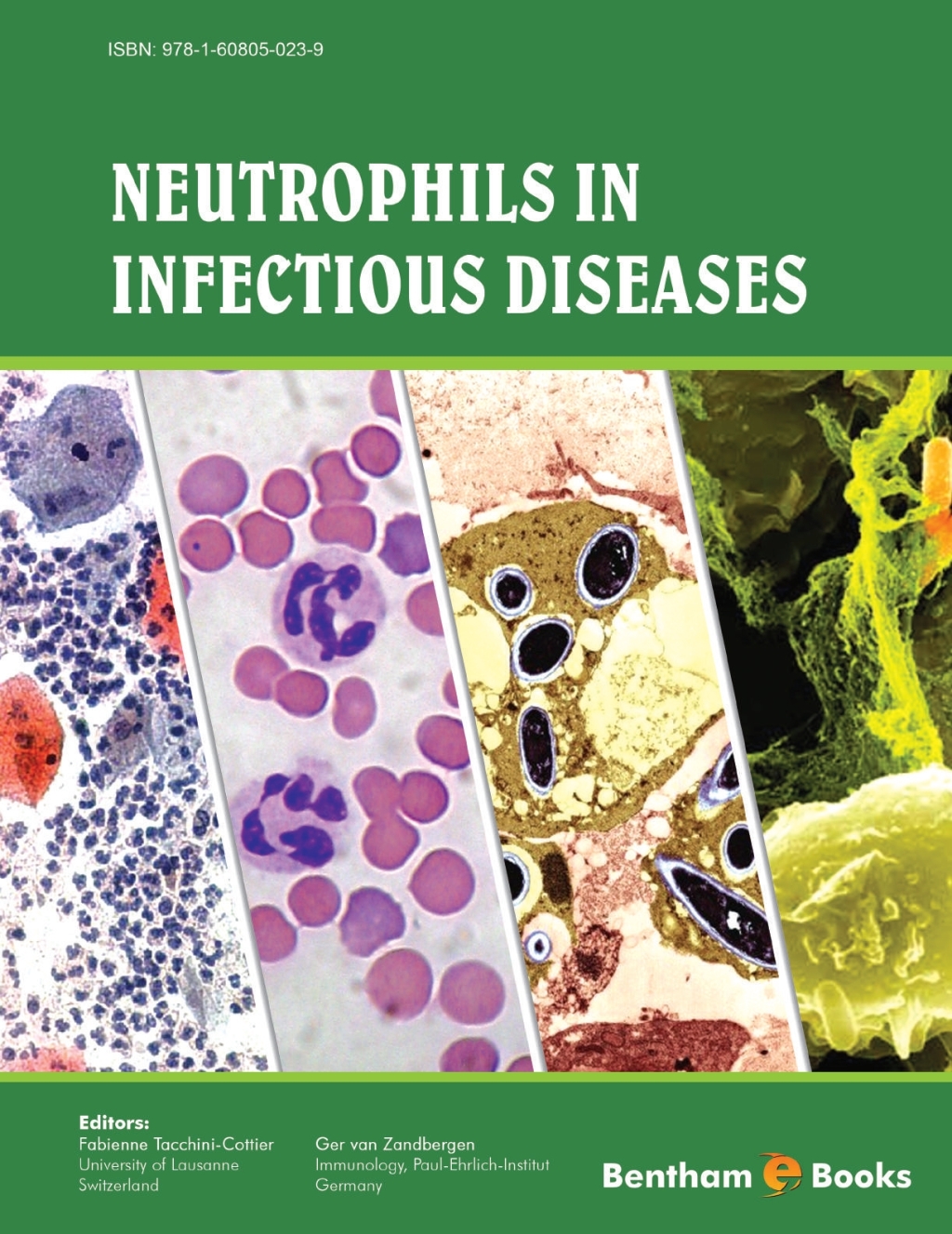 Neutrophils in Infectious Diseases 1st Edition â€“ PDF/EPUB Version Downloadable