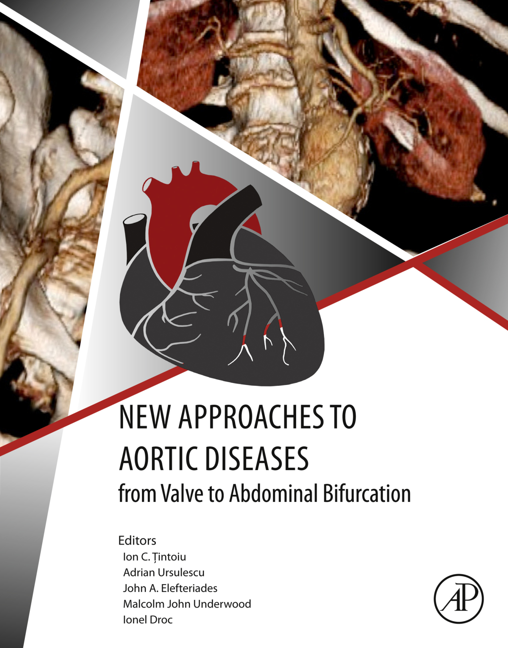 New Approaches to Aortic Diseases from Valve to Abdominal Bifurcation  â€“ PDF/EPUB Version Downloadable