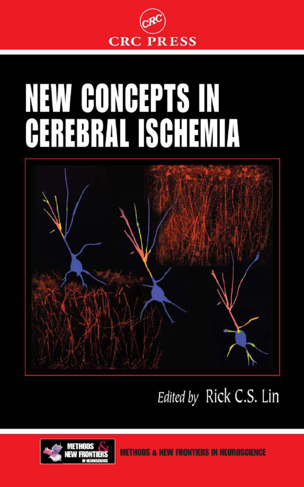 New Concepts in Cerebral Ischemia 1st Edition â€“ PDF/EPUB Version Downloadable