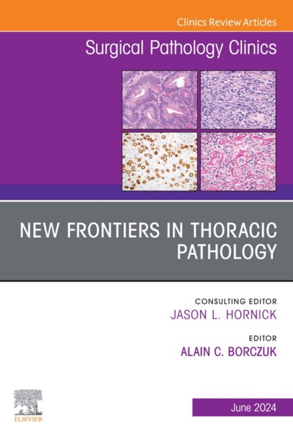 New Frontiers in Thoracic Pathology, An Issue of Surgical Pathology Clinics 1st Edition â€“ PDF/EPUB Version Downloadable