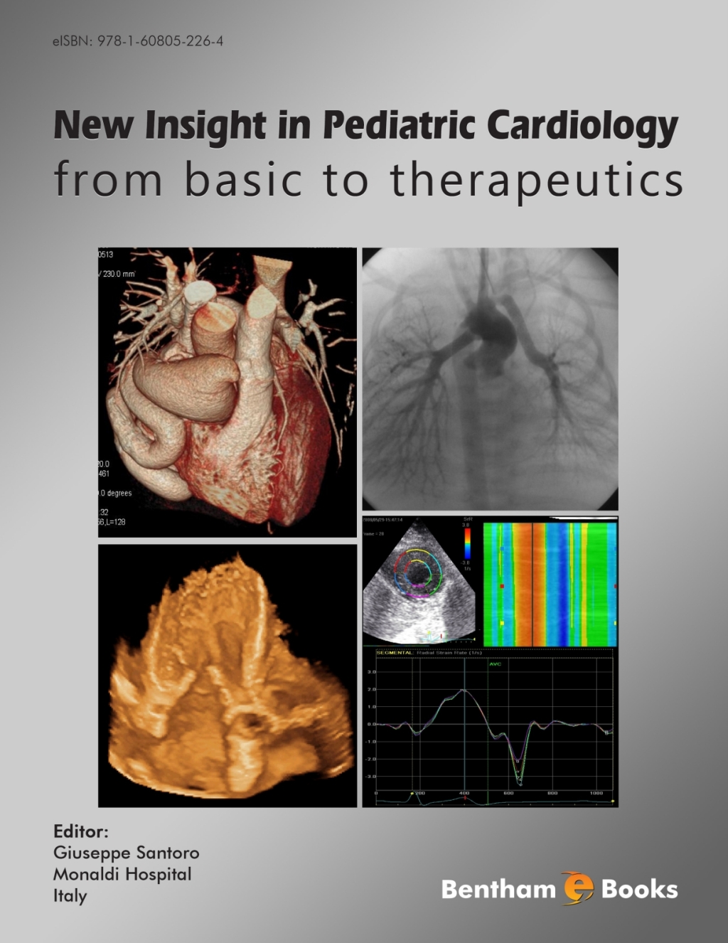New Insight in Pediatric Cardiology: From Basic to Therapeutics 1st Edition â€“ PDF/EPUB Version Downloadable