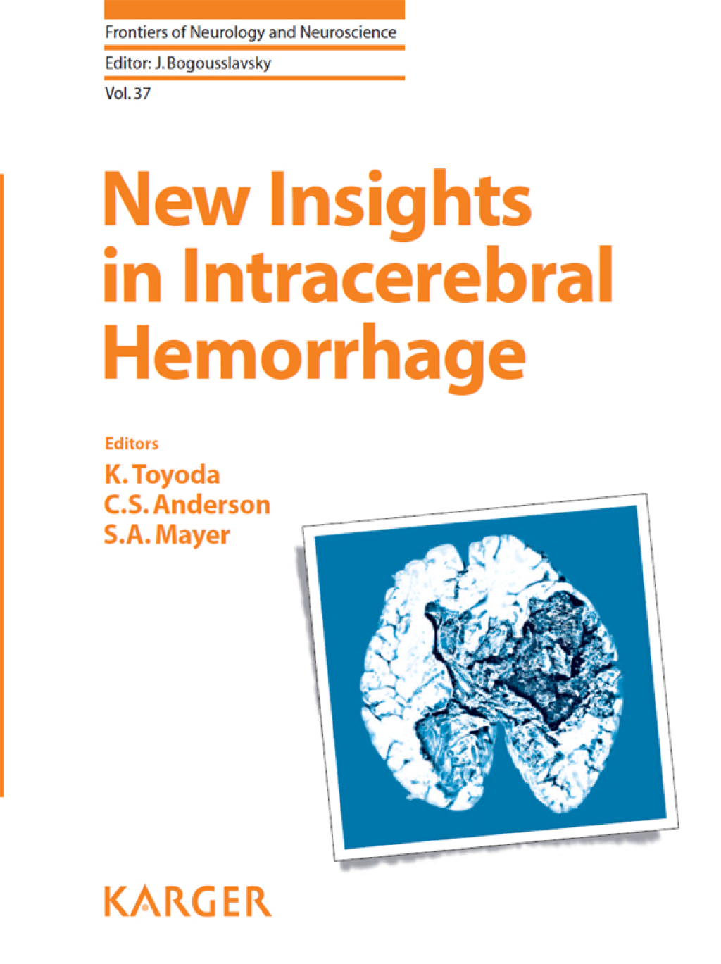 New Insights in Intracerebral Hemorrhage 1st Edition â€“ PDF/EPUB Version Downloadable