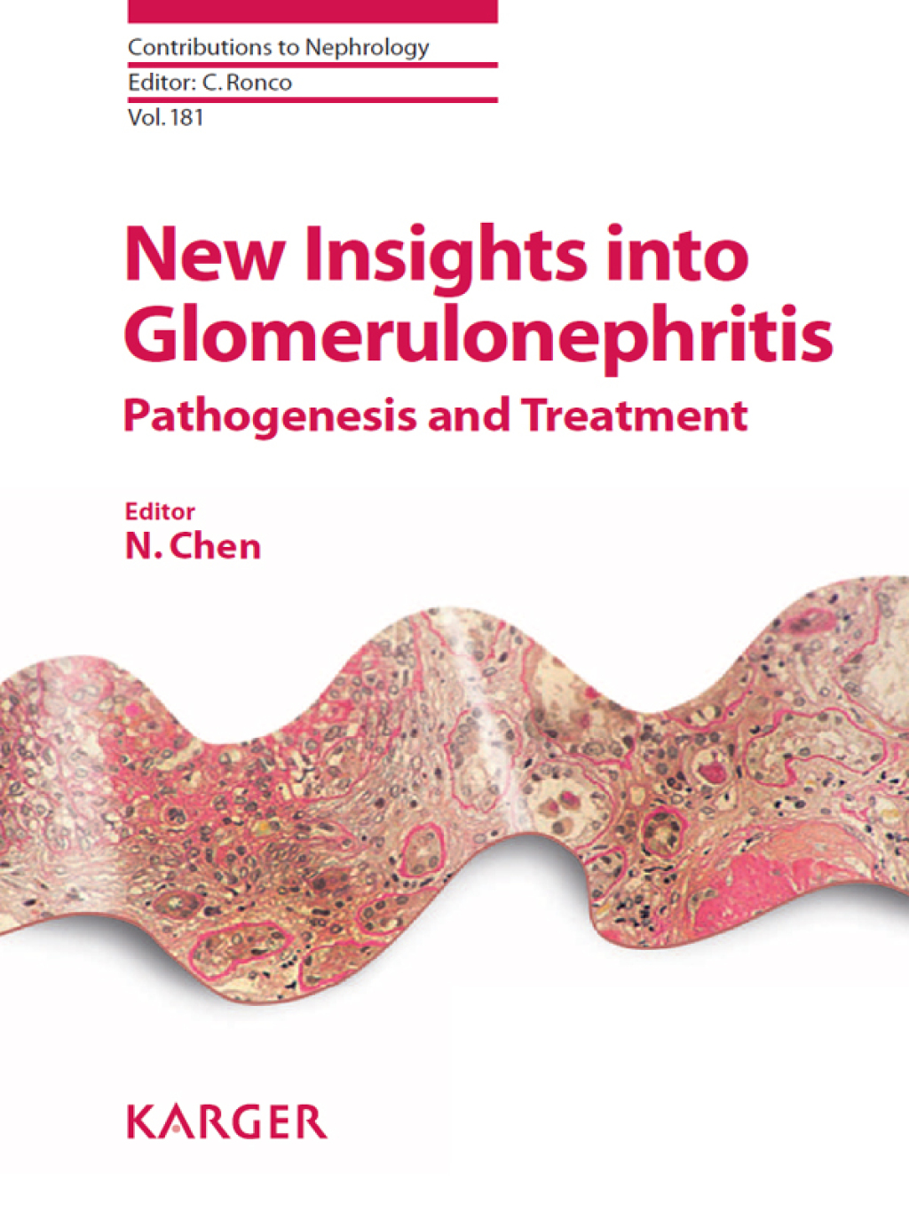 New Insights into Glomerulonephritis Pathogenesis and Treatment 1st Edition â€“ PDF/EPUB Version Downloadable