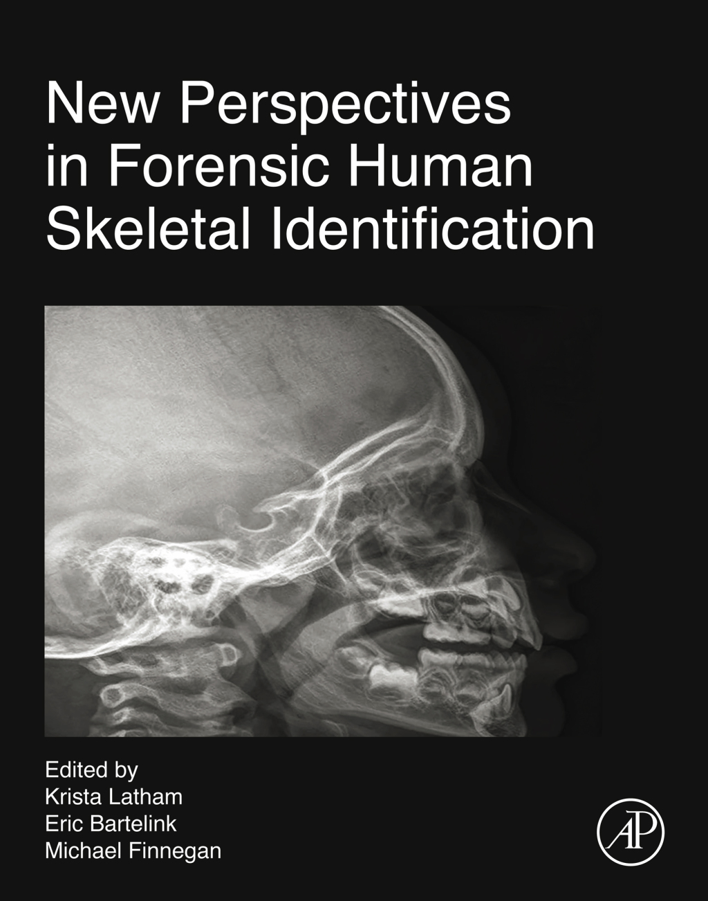 New Perspectives in Forensic Human Skeletal Identification  â€“ PDF/EPUB Version Downloadable
