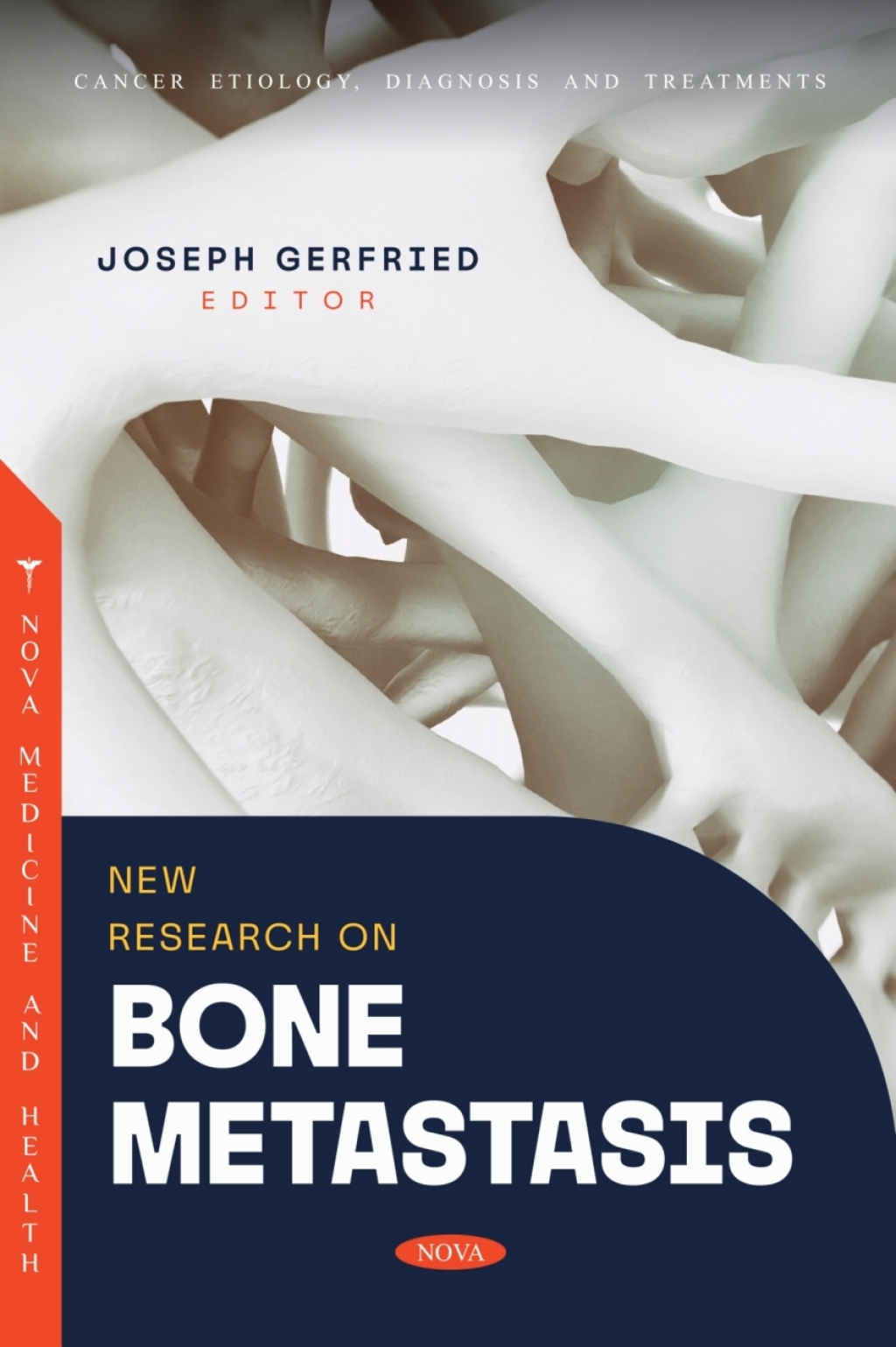 New Research on Bone Metastasis  â€“ PDF/EPUB Version Downloadable