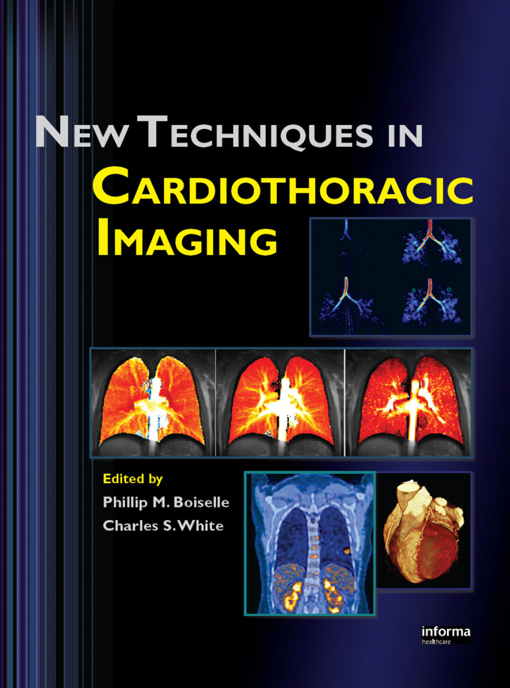 New Techniques in Cardiothoracic Imaging 1st Edition â€“ PDF/EPUB Version Downloadable