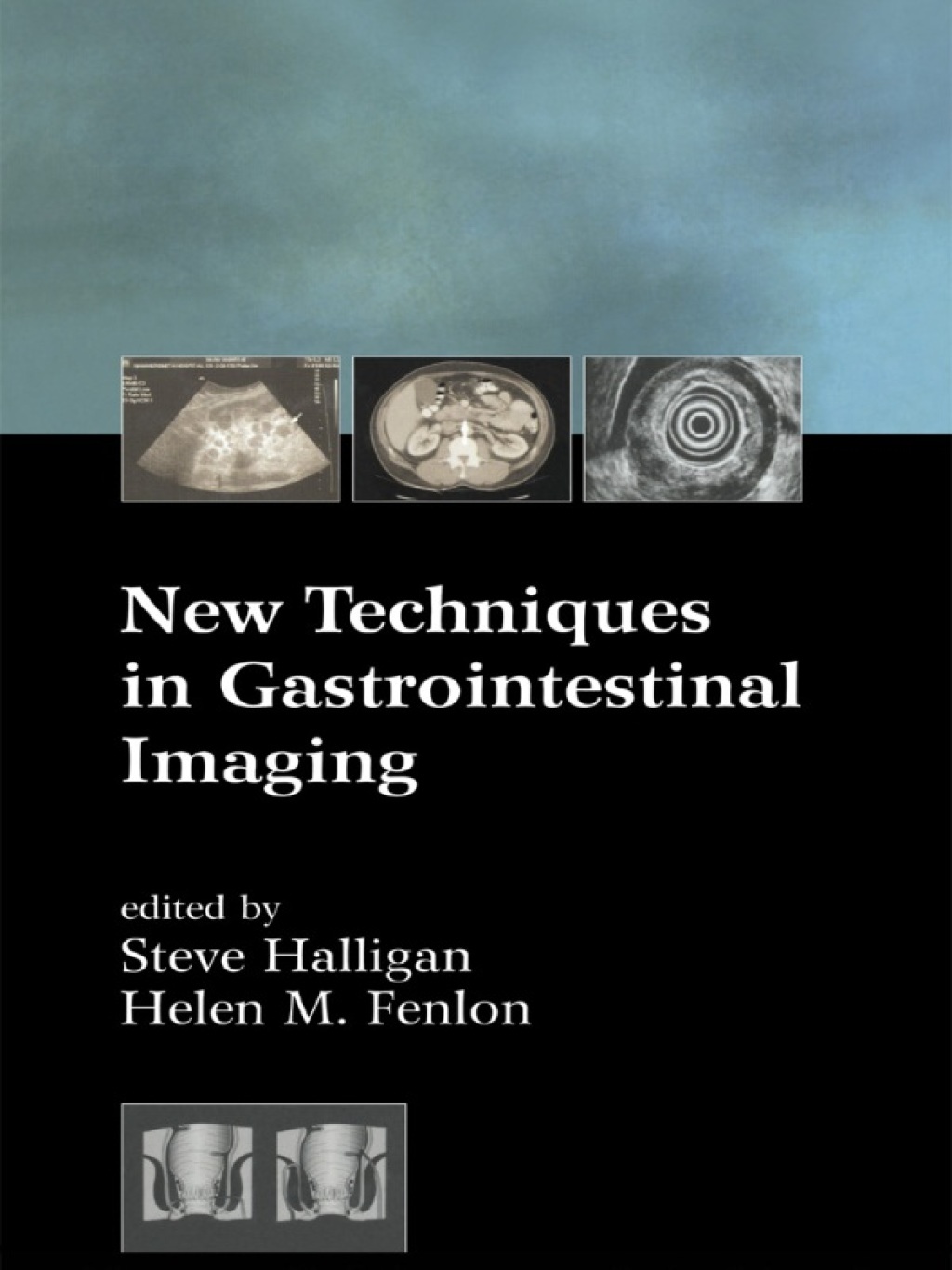 New Techniques in Gastrointestinal Imaging 1st Edition â€“ PDF/EPUB Version Downloadable