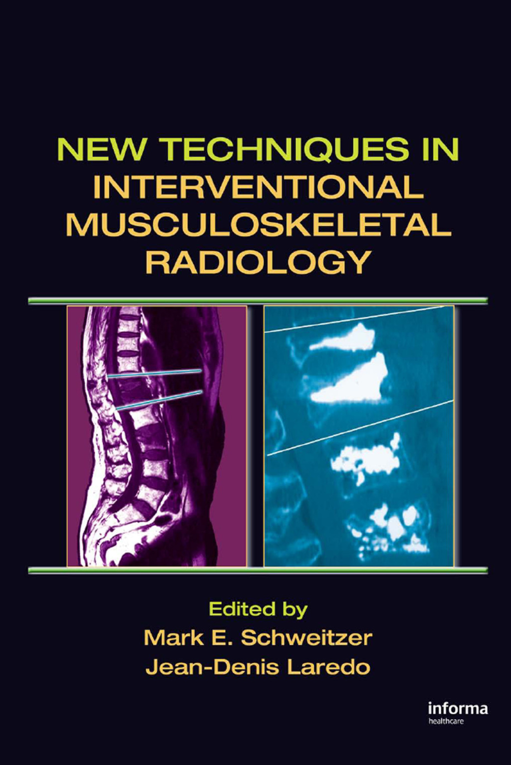 New Techniques in Interventional Musculoskeletal Radiology 1st Edition â€“ PDF/EPUB Version Downloadable
