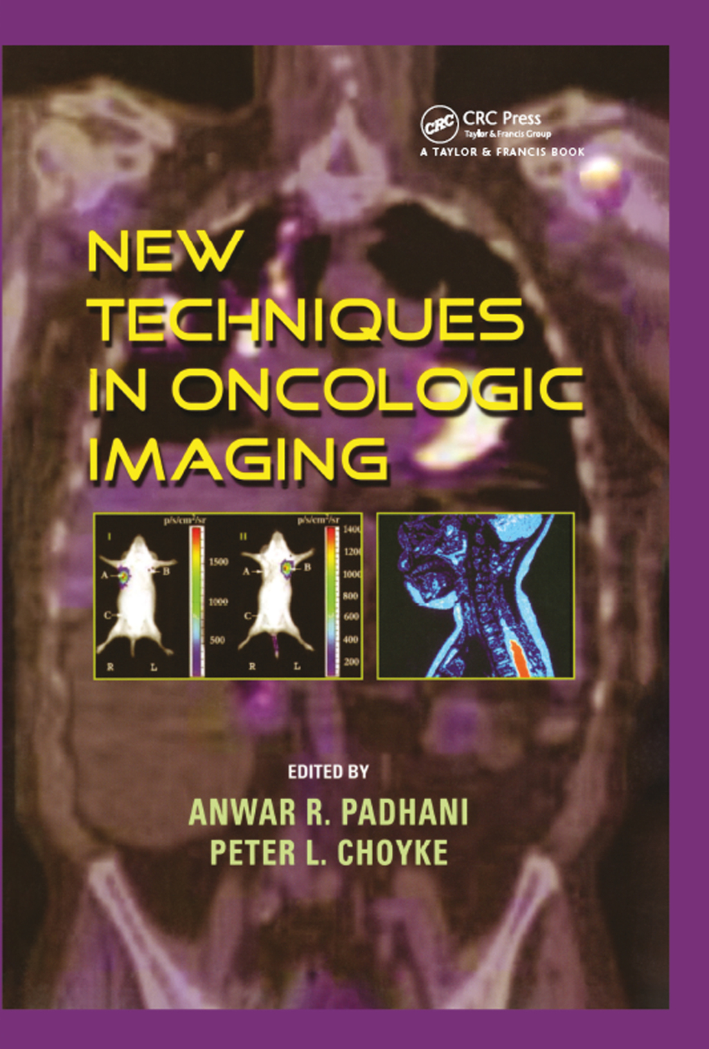 New Techniques in Oncologic Imaging 1st Edition â€“ PDF/EPUB Version Downloadable