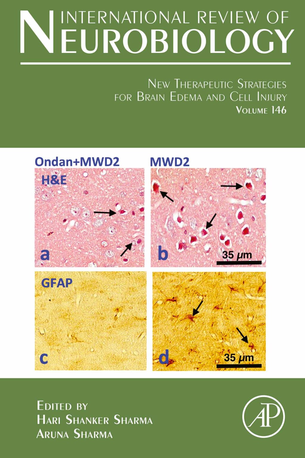 New Therapeutic Strategies for Brain Edema and Cell Injury  â€“ PDF/EPUB Version Downloadable