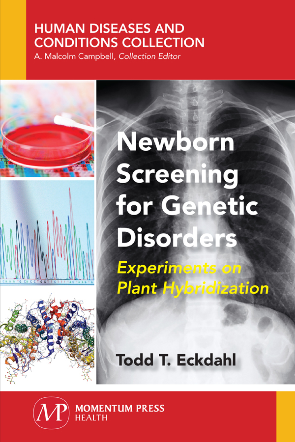 Newborn Screening for Genetic Disorders Experiments on Plant Hybridization - (PDF/EPUB Version)