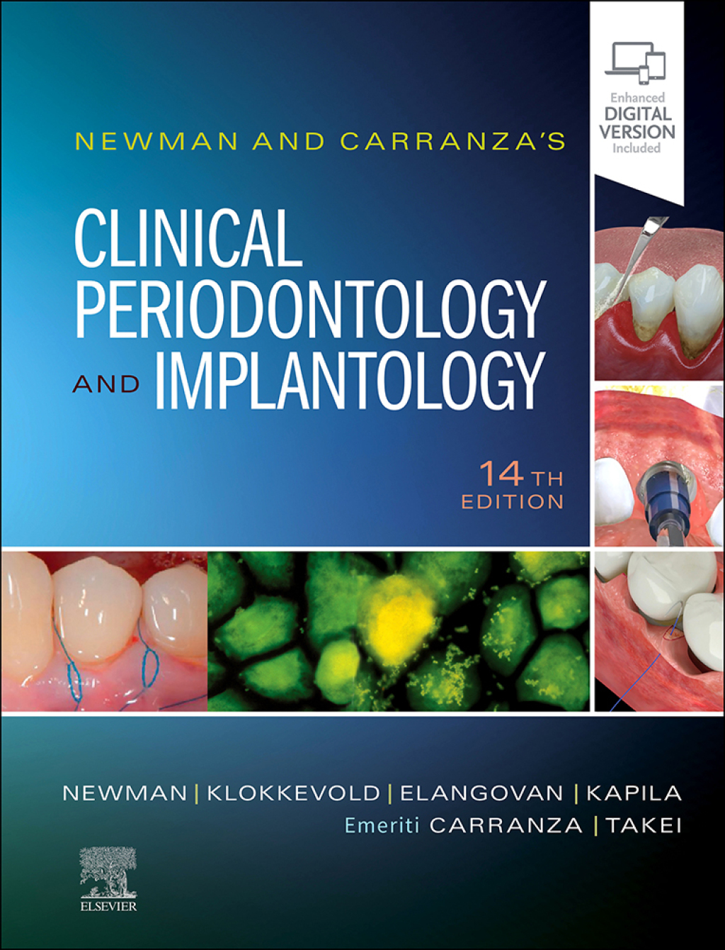 Newman and Carranza's Clinical Periodontology and Implantology 14th Edition â€“ PDF/EPUB Version Downloadable