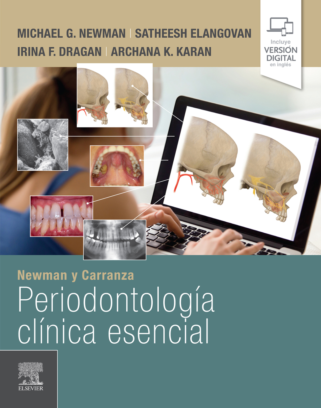 Newman y Carranza. PeriodontologÃ­a clÃ­nica esencial 1st Edition â€“ PDF/EPUB Version Downloadable