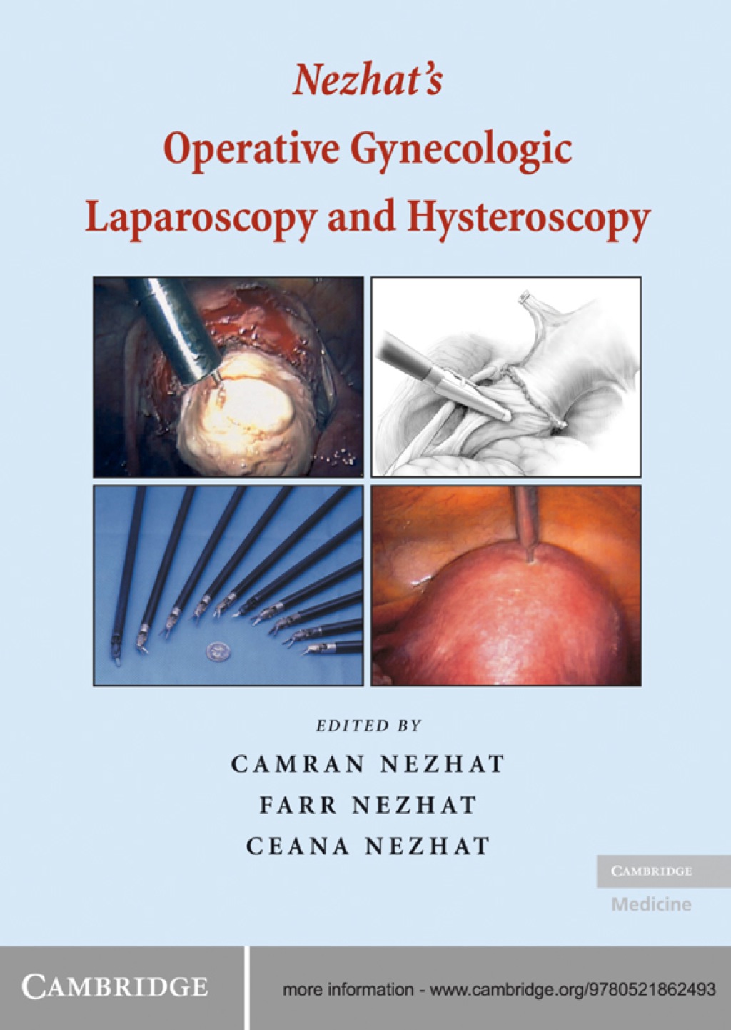 Nezhat's Operative Gynecologic Laparoscopy and Hysteroscopy 3rd Edition â€“ PDF/EPUB Version Downloadable