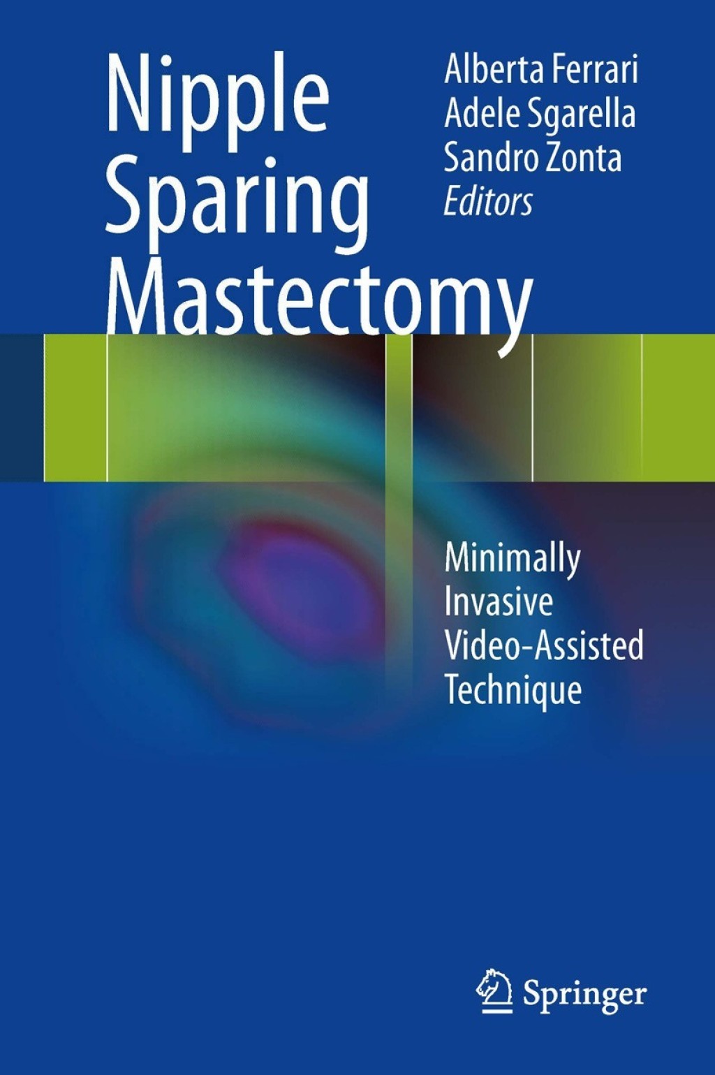 Nipple Sparing Mastectomy Minimally Invasive Video-Assisted Technique  â€“ PDF/EPUB Version Downloadable